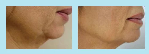 accent your body 6