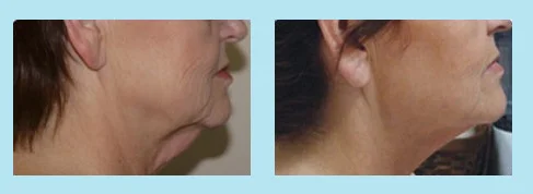 accent your body 5