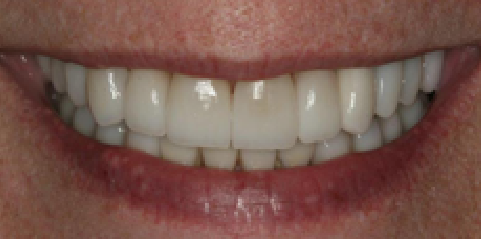 10b-1.png
