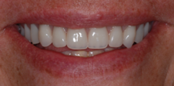 4b-1.png