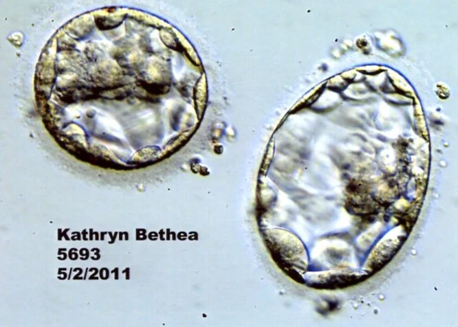 Bethea_Day5_Blastocyst_05022011.jpg