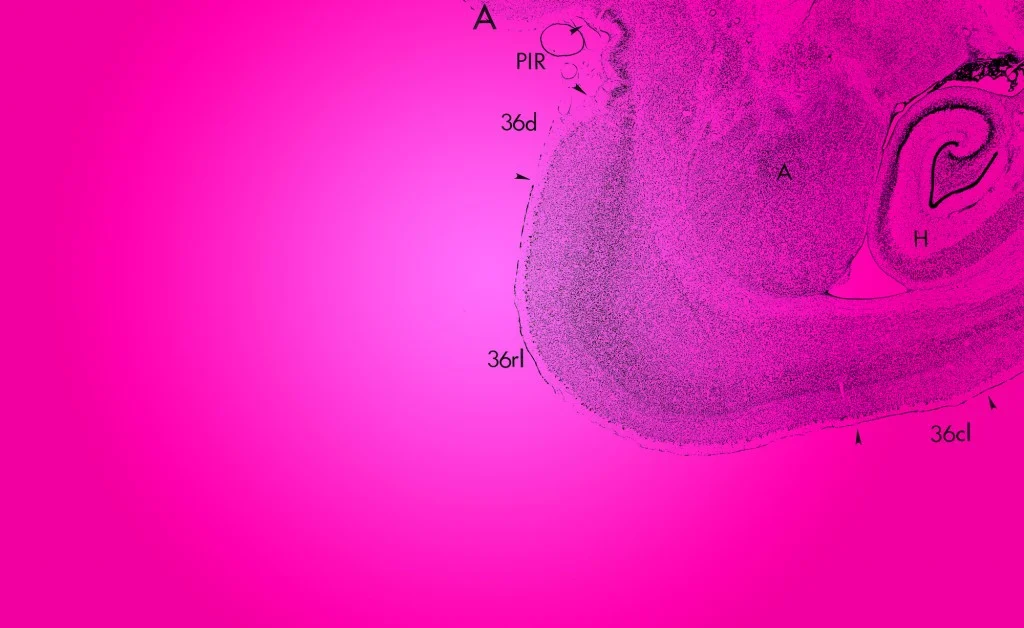 BRAIN HACK 1