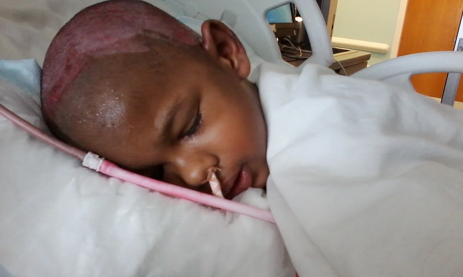 During Treatment