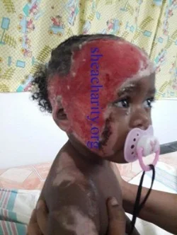 Ranie at age 16 months