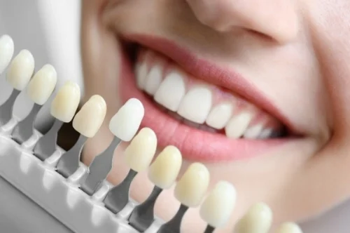 Honest_Teeth_Elm Grove_cosmetic_dentistry.jpeg