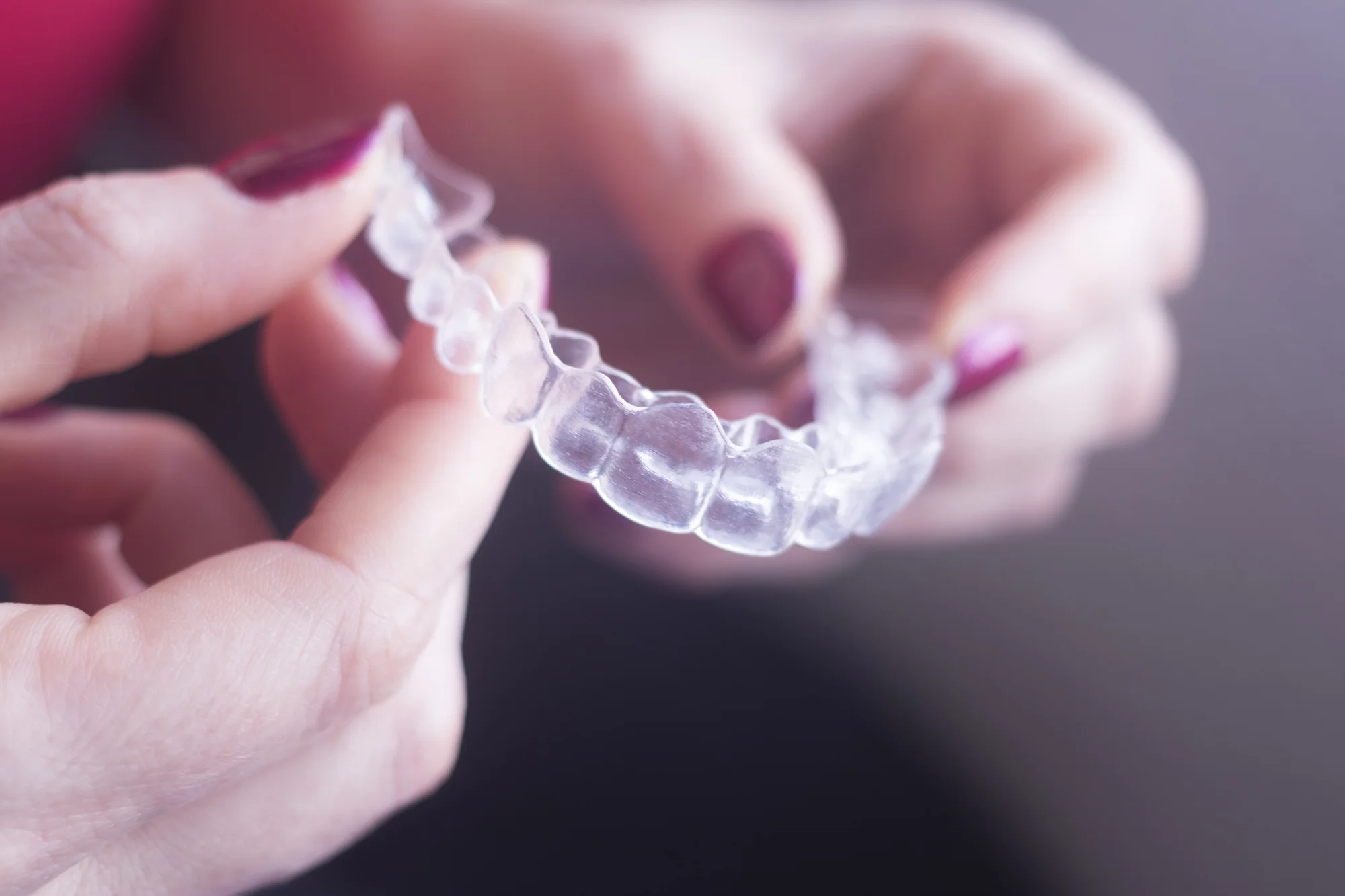 The History Of Invisalign: Learn More About This Clear Braces Alternative!