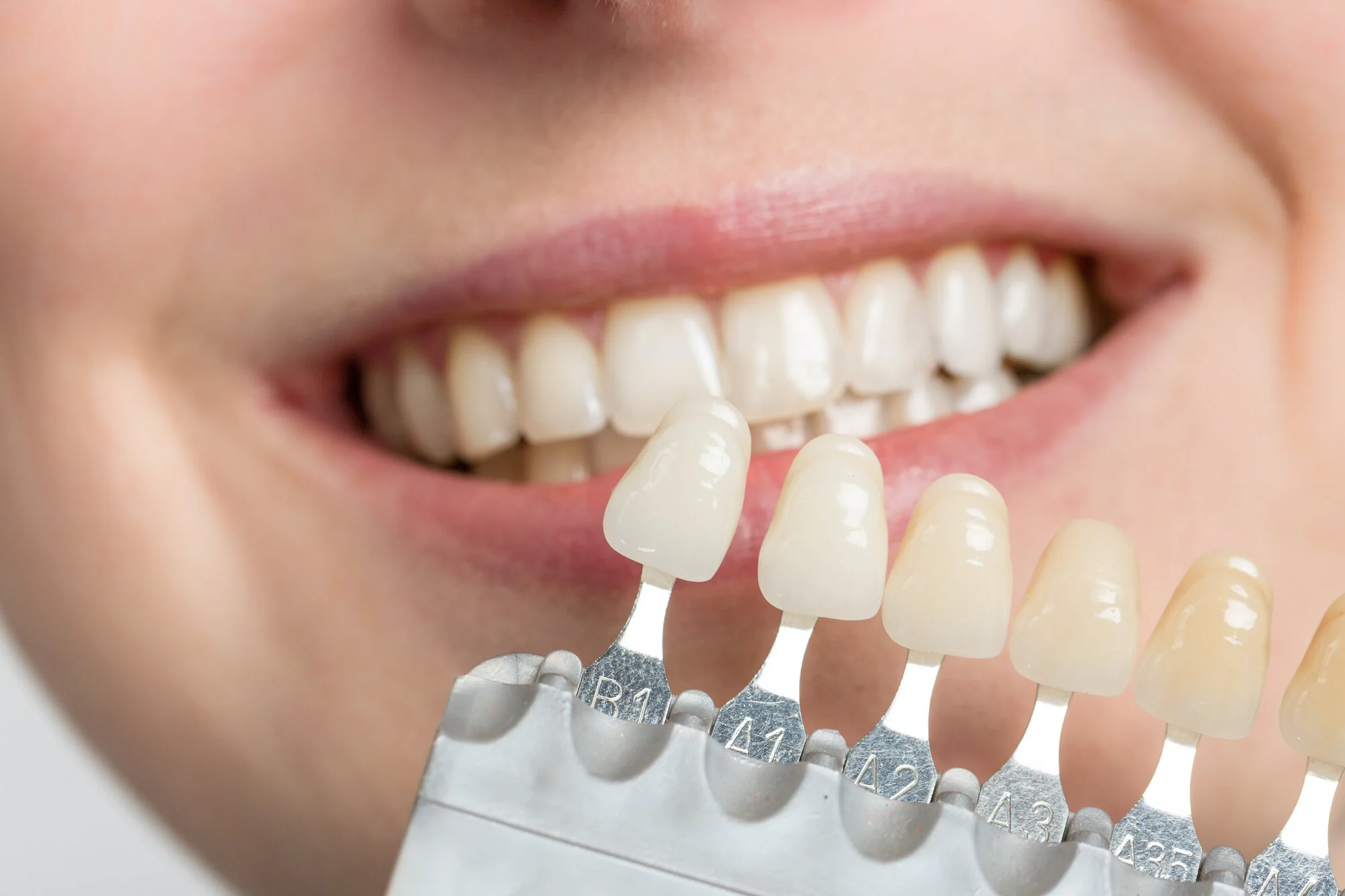 Honest Blog — Honest Teeth Dentistry Honest Blog — Honest Teeth Dentistry