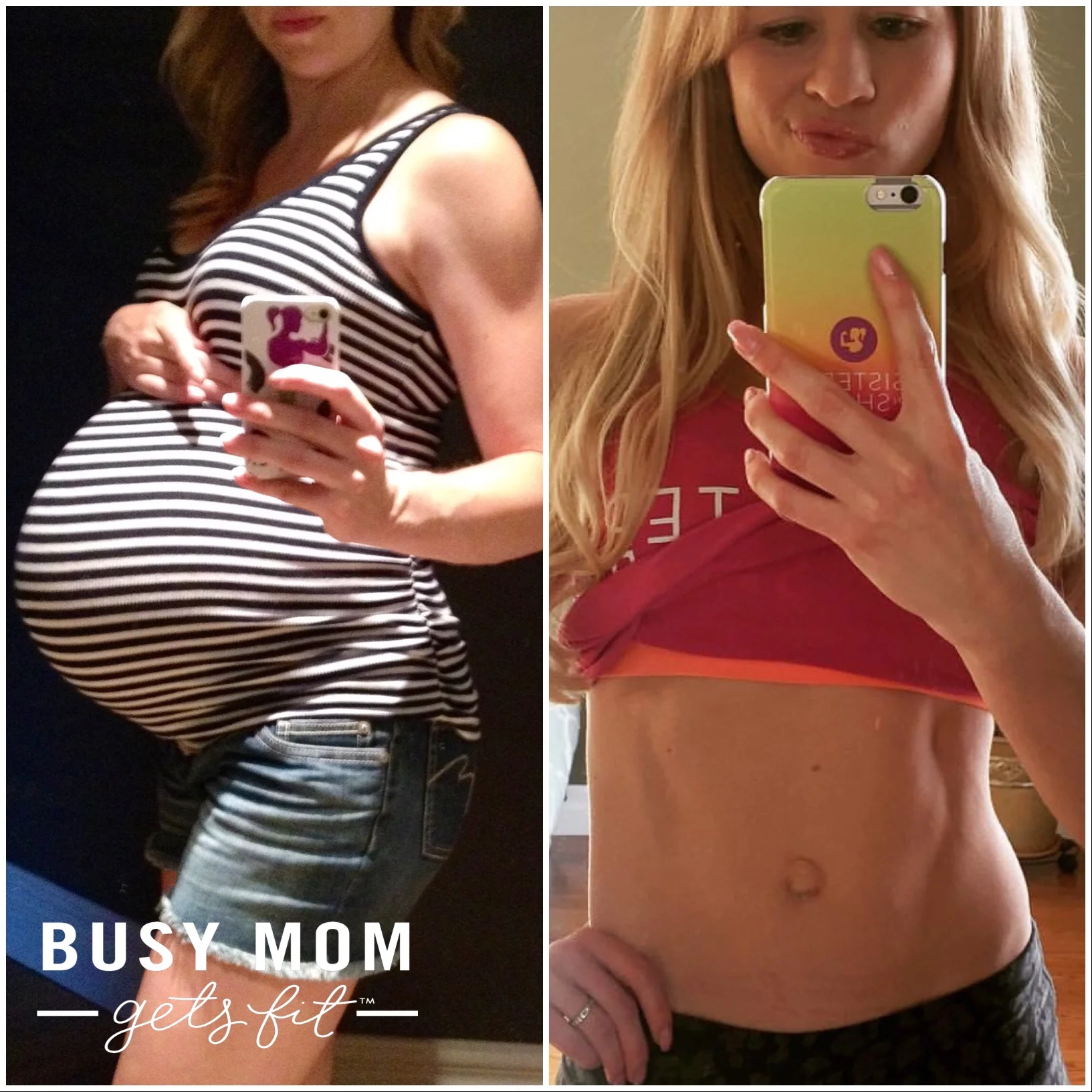 Now I've Got an "Outtie" Belly Button?!