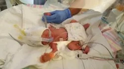 triplets 10.jpg