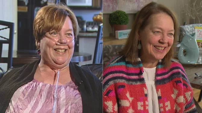 Kate McGoey-Smith Before & After