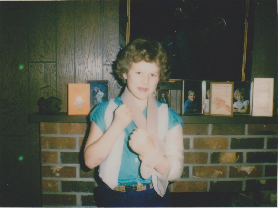 M broken arm march 1981.jpeg