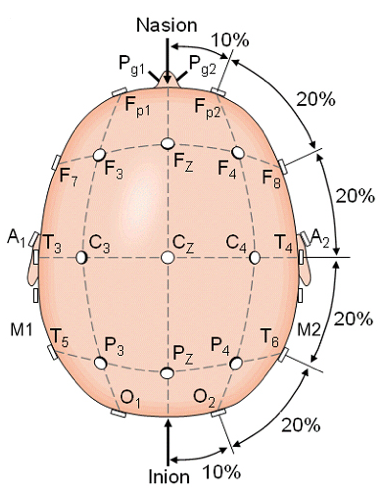 Electrode placement is made consistent via the so called 10-20 system