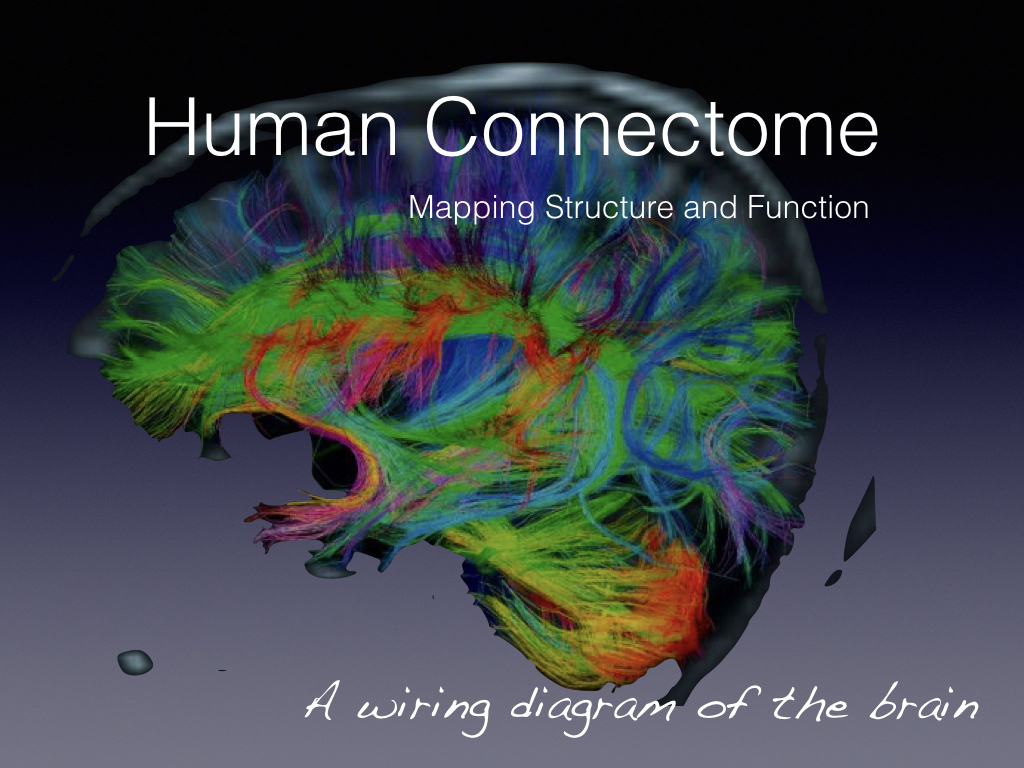 Research has shown how massively interconnected areas of the brain are