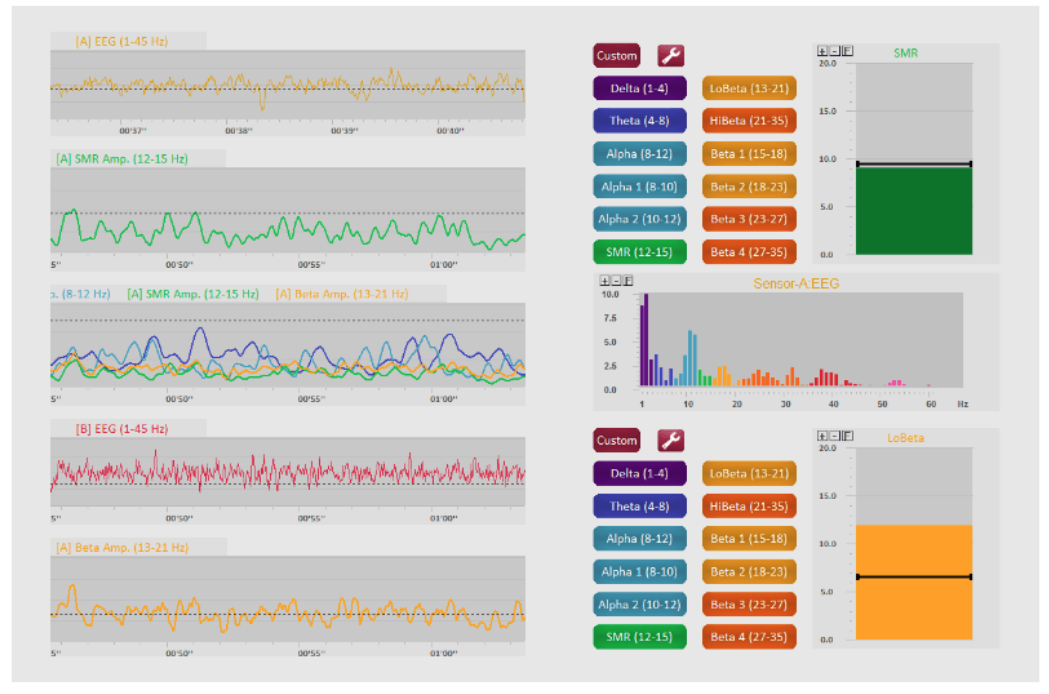 EEG bands