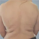 Before Body FX