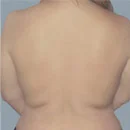 After BodyFX