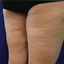 Before BodyFx