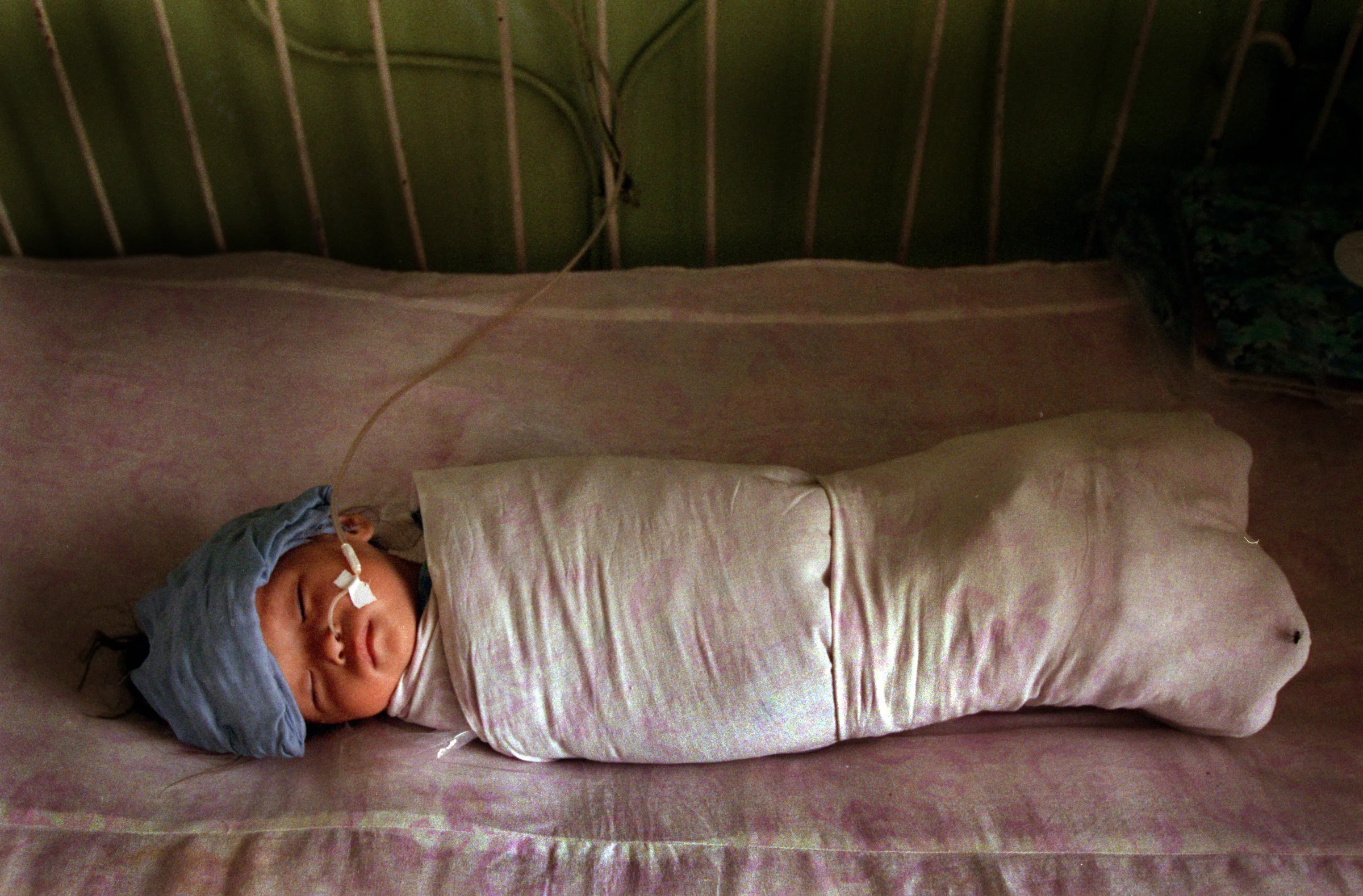 Because of the Mongolian tradition of swaddling babies during the first year of life, infants don't receive vitamin D from its natural source, sunlight. As a result, rickets, which causes bone malformations, is common among children. ©Gail Fisher/Los Angeles Times