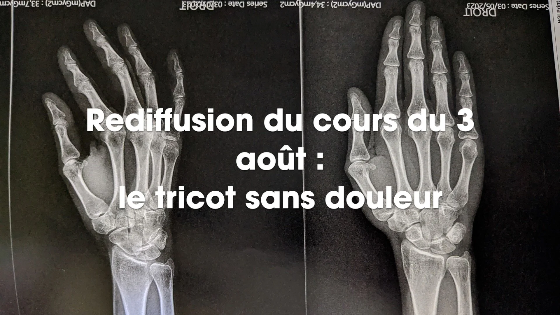 Le tricot sans douleurs