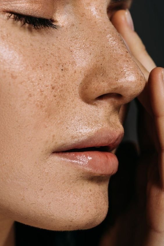 Everything you need to know about azelaic acid
