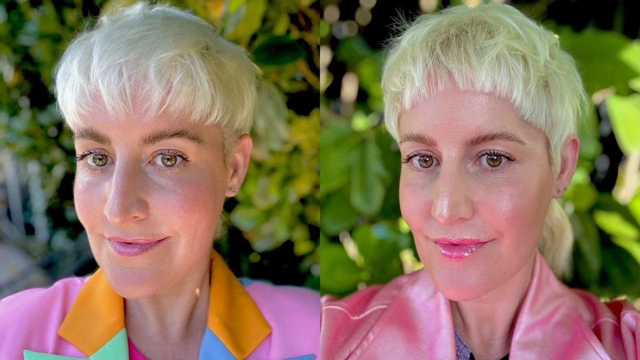Everything You Need to Know About Lip Filler