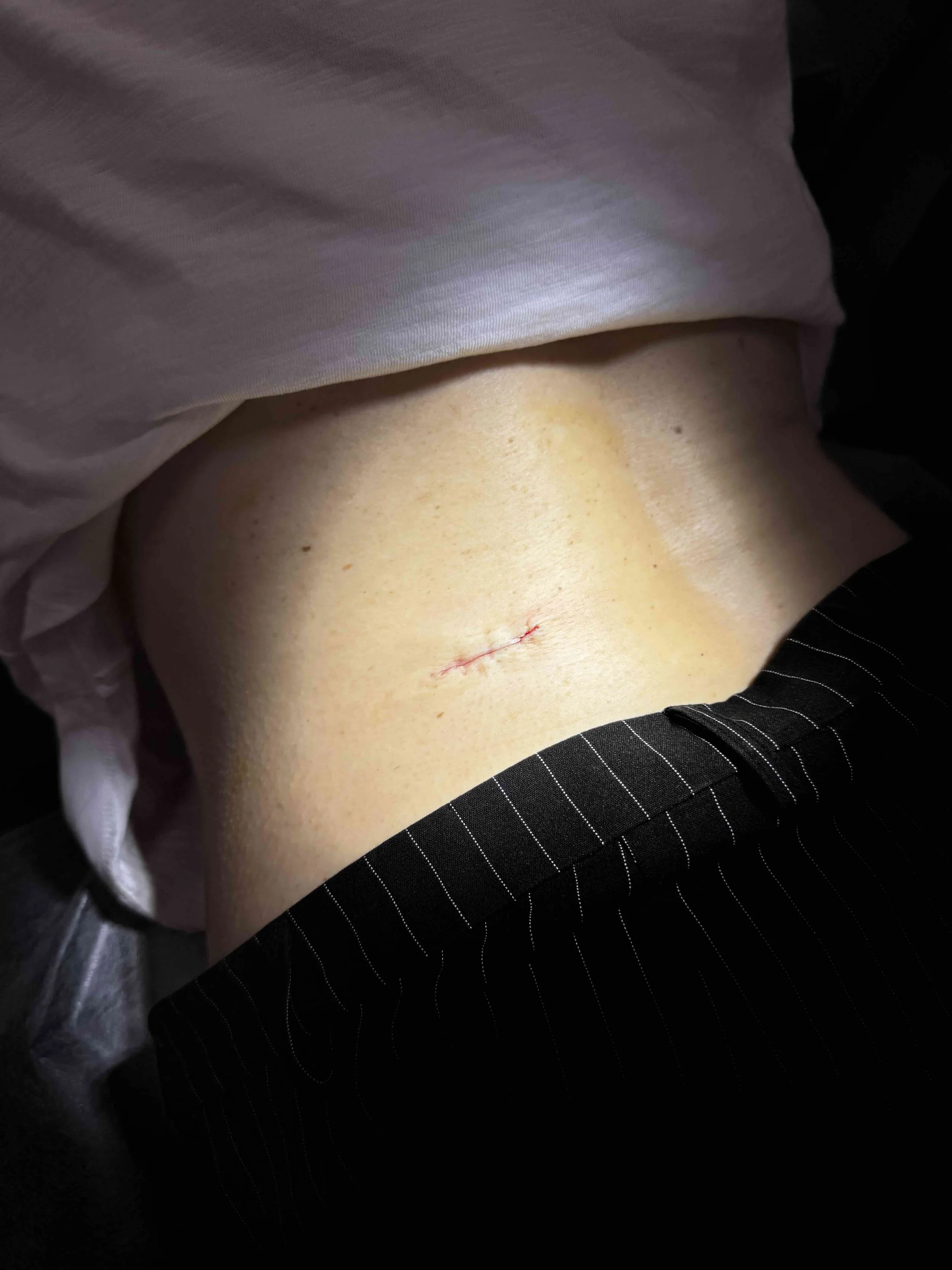 A skin cancer wake up call