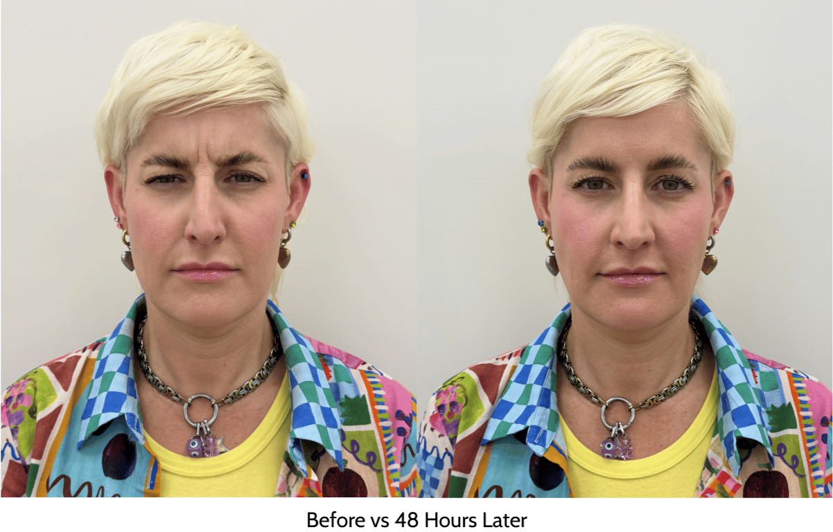 Discover Relfydess: The new fast-acting neurotoxin