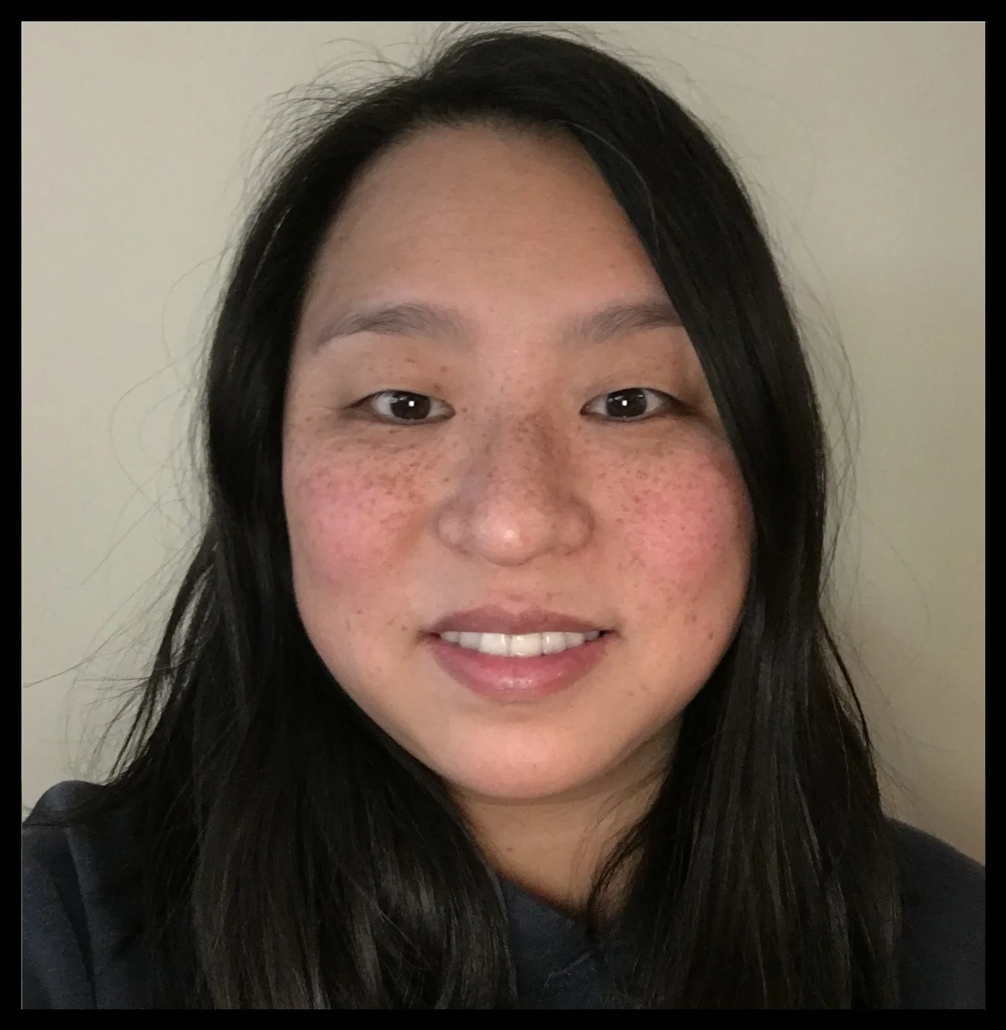 Arlene Chair and Founder Is the Chair and Founder of Seattle Parents of Preemies and a volunteer with the EvergreenHealth NICU Parent Advisory Board. Her boy/girl twins were born prematurely at 30 weeks gestation. Arlene is passionate about advocacy for preemie parents and families. Her interests are focused on raising awareness of perinatal mental health disorders common in preemie/NICU parents and supporting parents as they navigate life after NICU hospital discharge. Arlene@SeattlePreemies.com