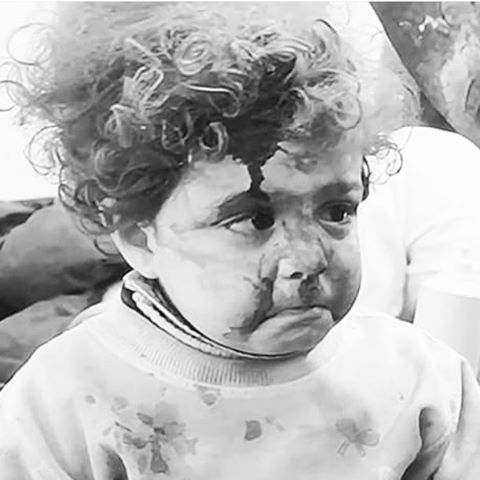 Esta &eacute; a Ayah, uma menininha de 3 anos que n&atilde;o conseguia nem mesmo chorar. N&atilde;o conhece a paz. Conhece a brutalidade, a intoler&acirc;ncia, a luta pelo poder, a dor, a perda e com certeza n&atilde;o compreende, assim como a gente 