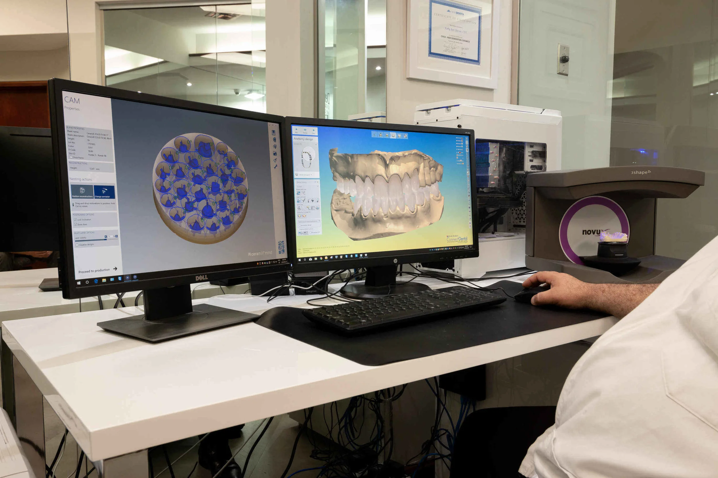 How computer guided dental implants is changing the dentistry industry