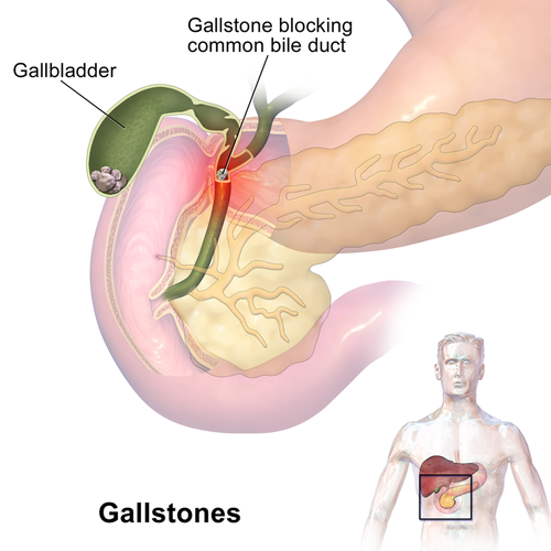 Liver & Gallbladder Flush — Northern Beaches Colon Hydrotherapy Liver & Gallbladder Flush — Northern Beaches Colon Hydrotherapy