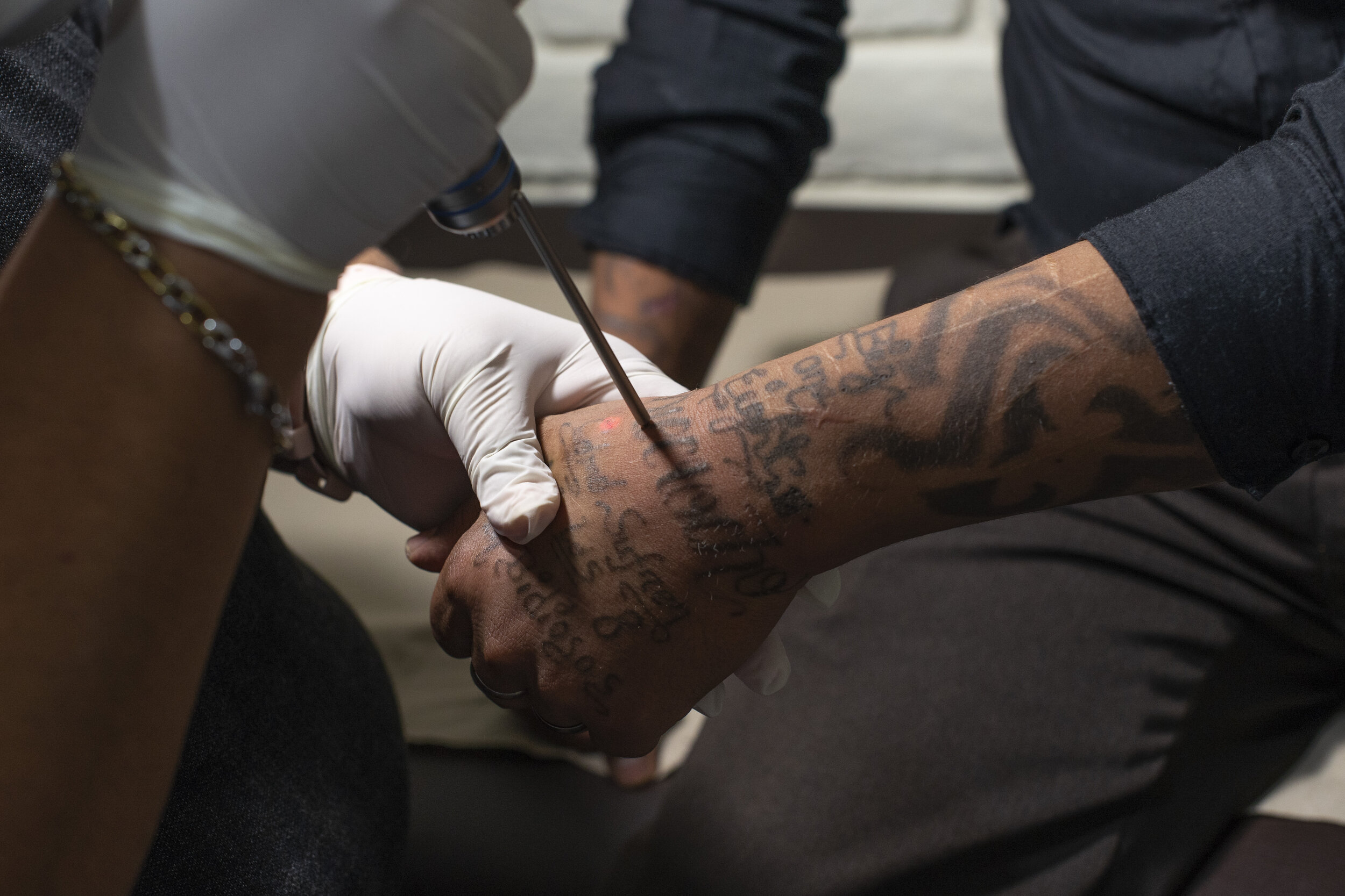  Melvin Eduardo Martinez Melara receiving a tattoo removal treatment.  