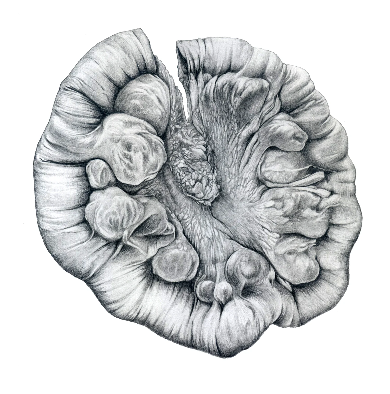 Jejunal diverticulosis Media: graphite