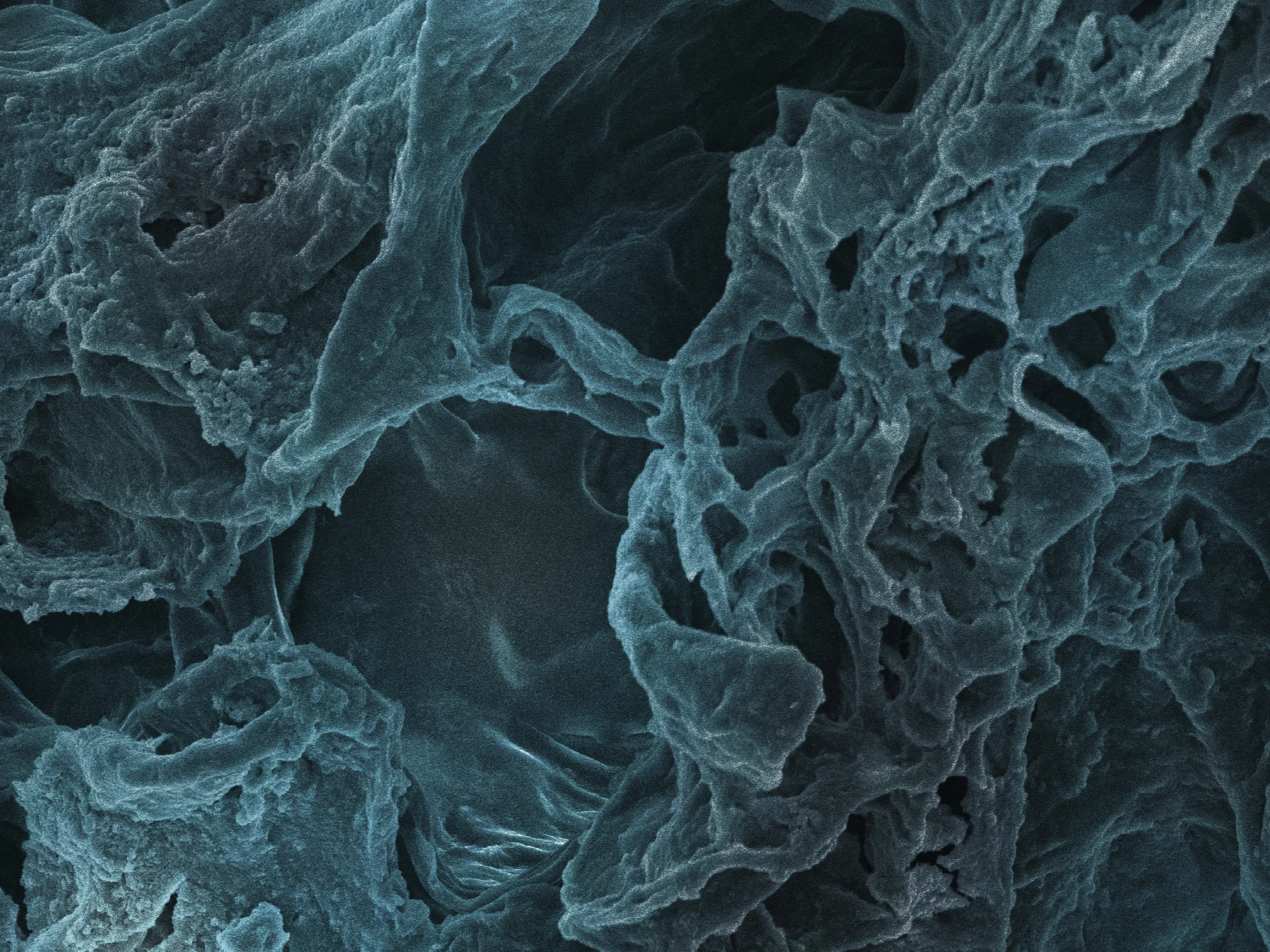 Anturium SEM image