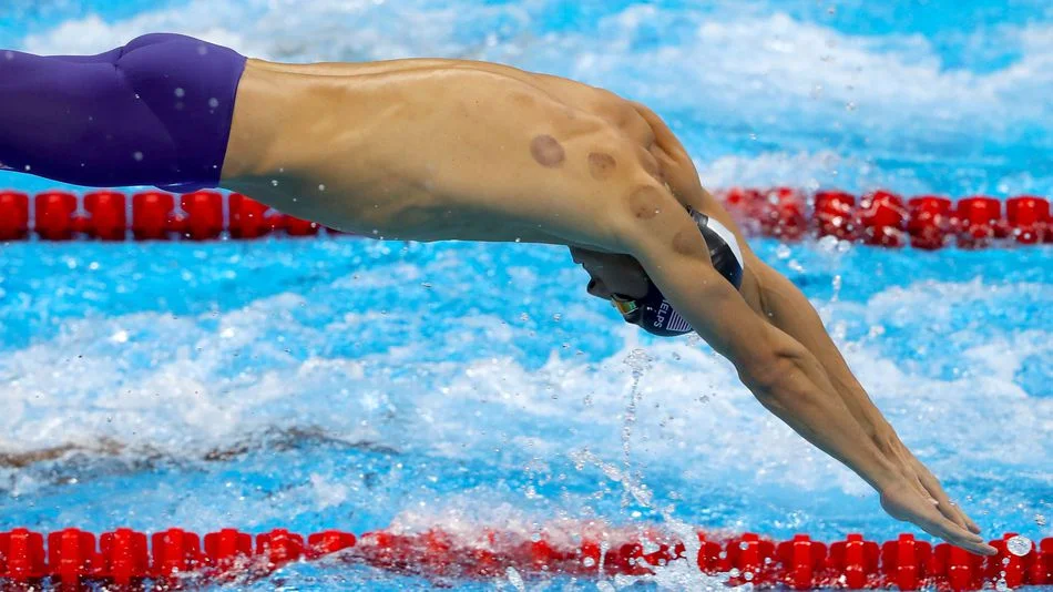 http://mashable.com/2016/08/08/what-science-says-cupping-phelps-rio/#EflEm8oSAaqa