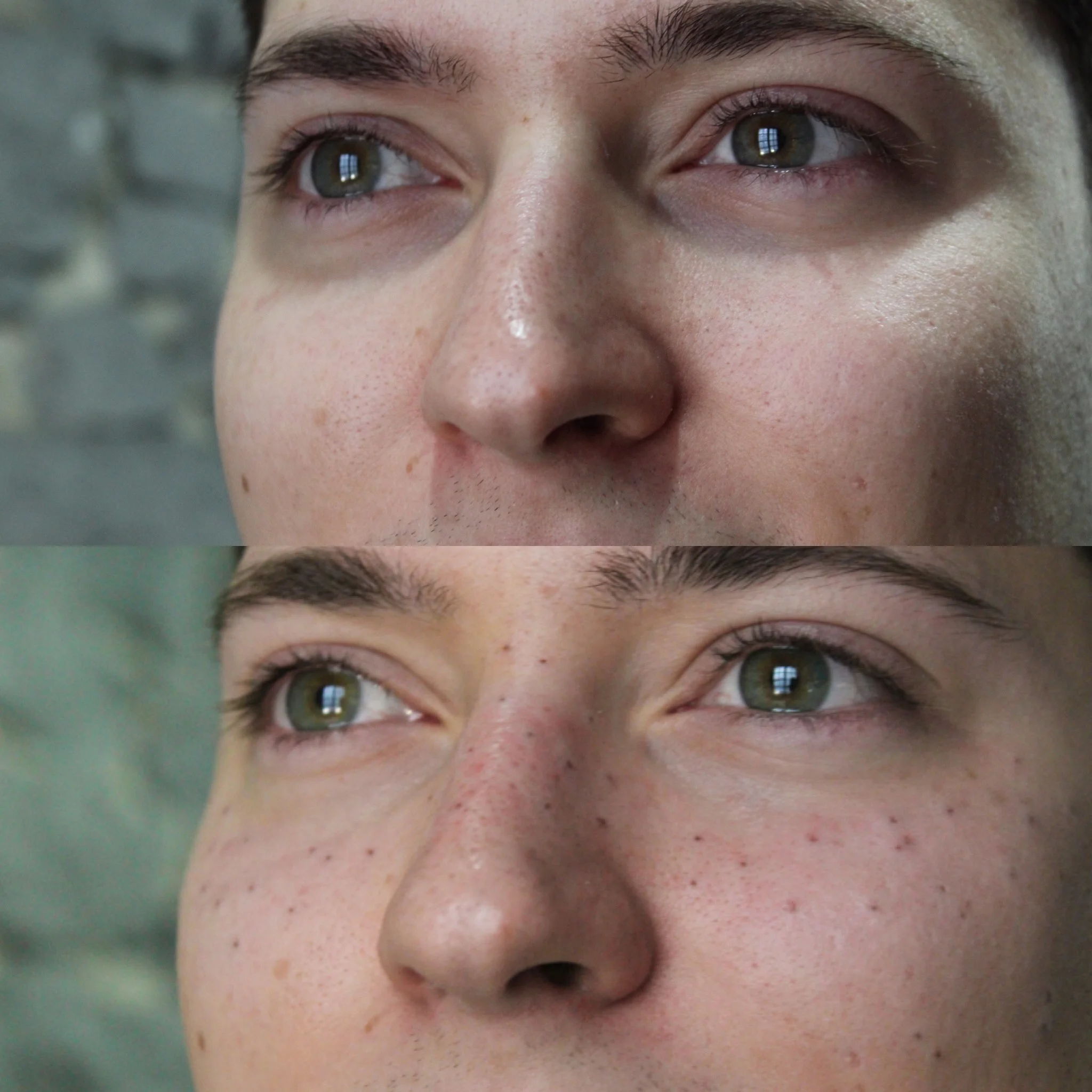 gui-freckles.jpeg