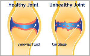 comvet-technyflex-heathly-joint-illustration.gif
