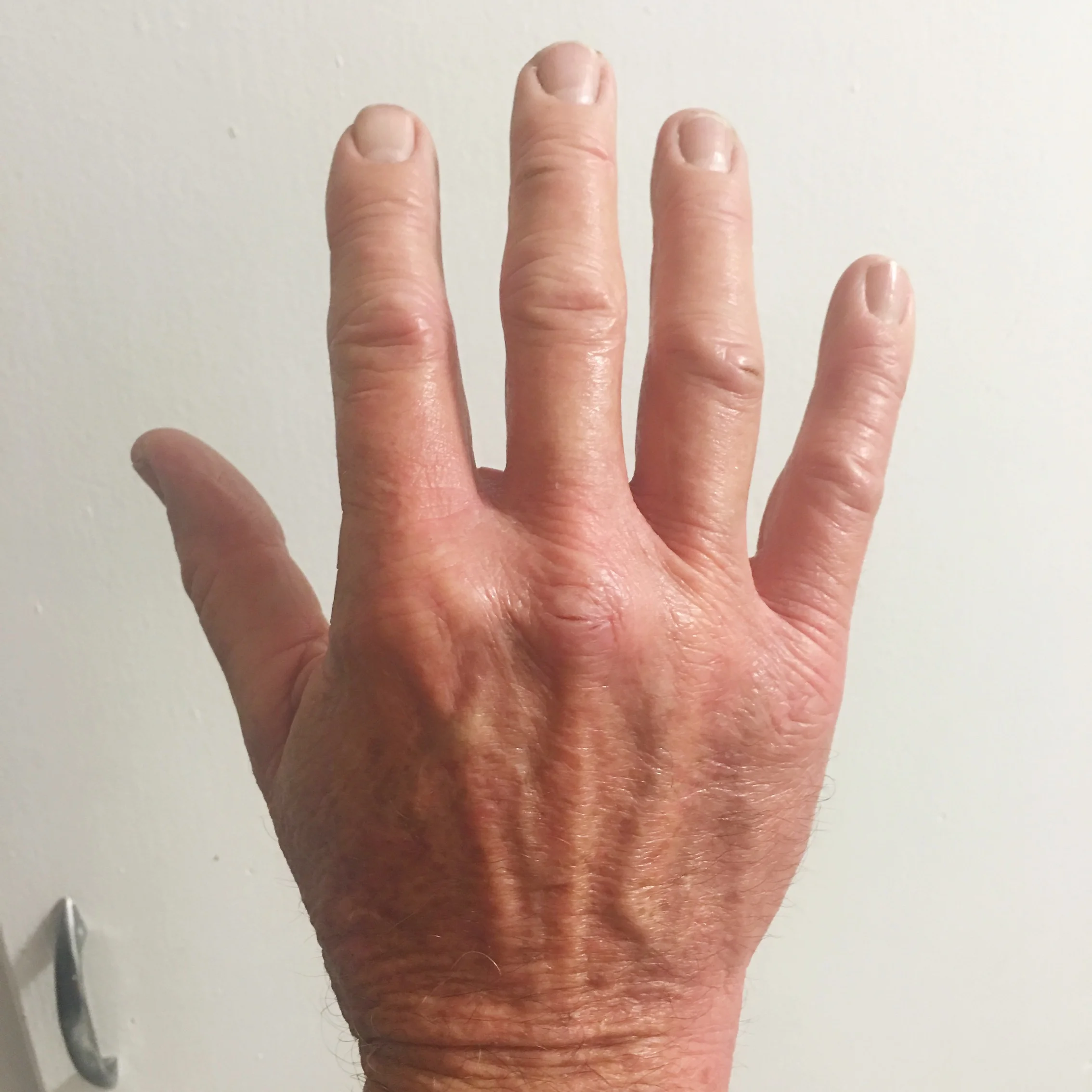 Hand Hydration: Before + After
