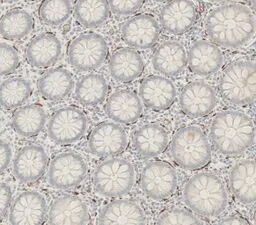 Cisarovsky - Tentacle Flowers - 40 x 40 cm - CHF 120.-