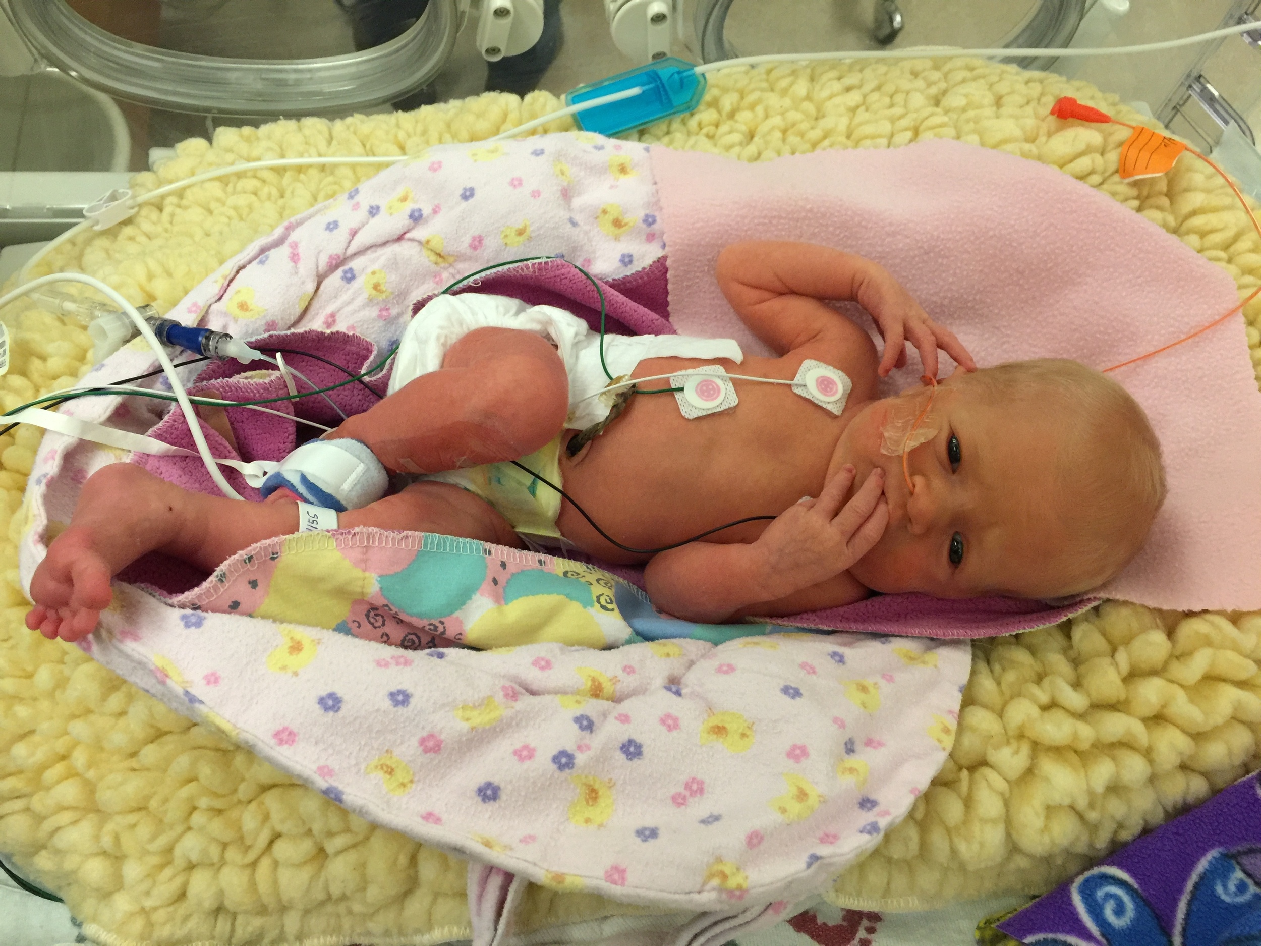 Claire at one week