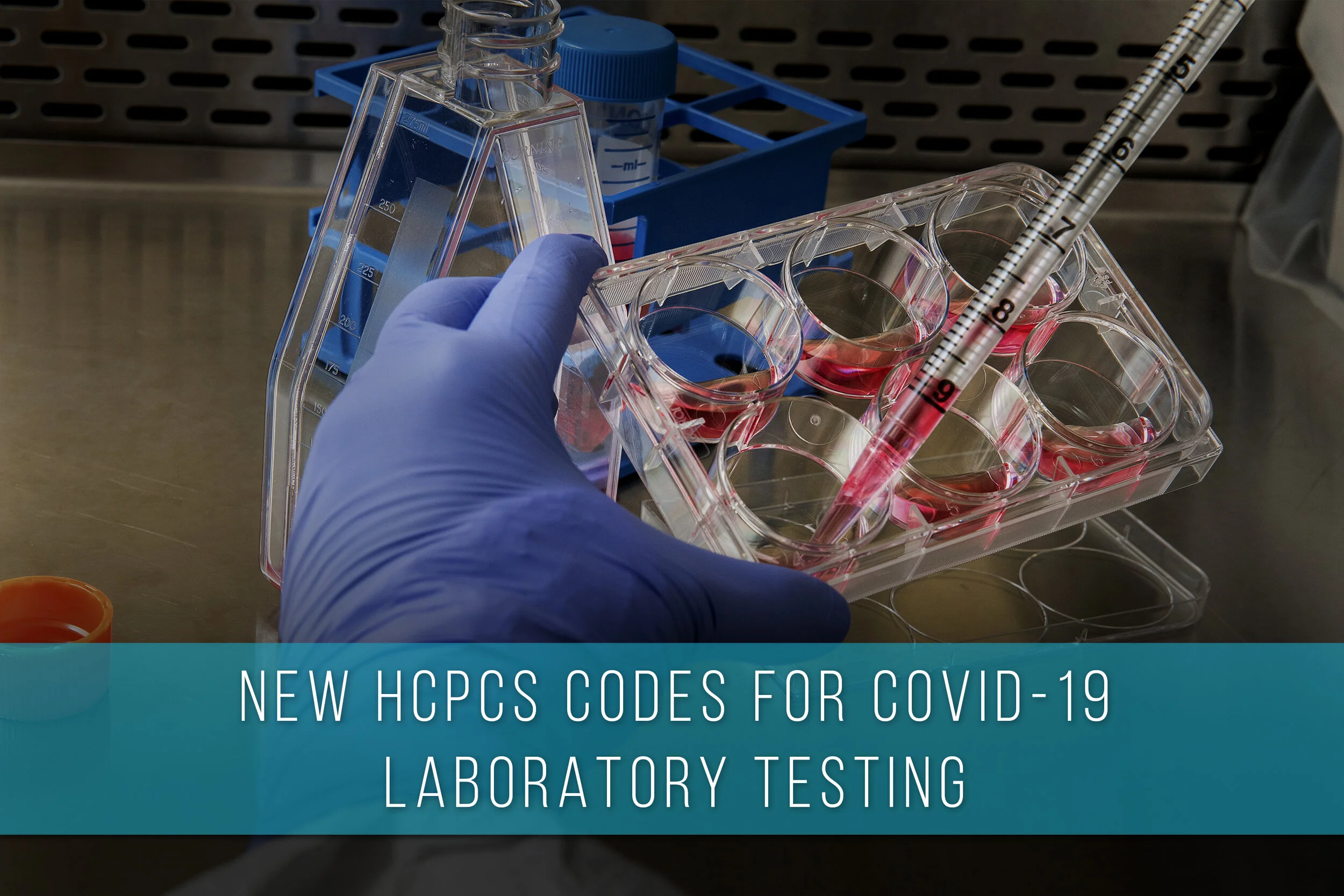 New HCPCS Codes for COVID-19 Laboratory Testing