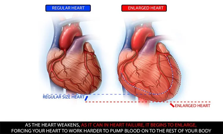 Untitled-2_0004_oversized heart.jpg