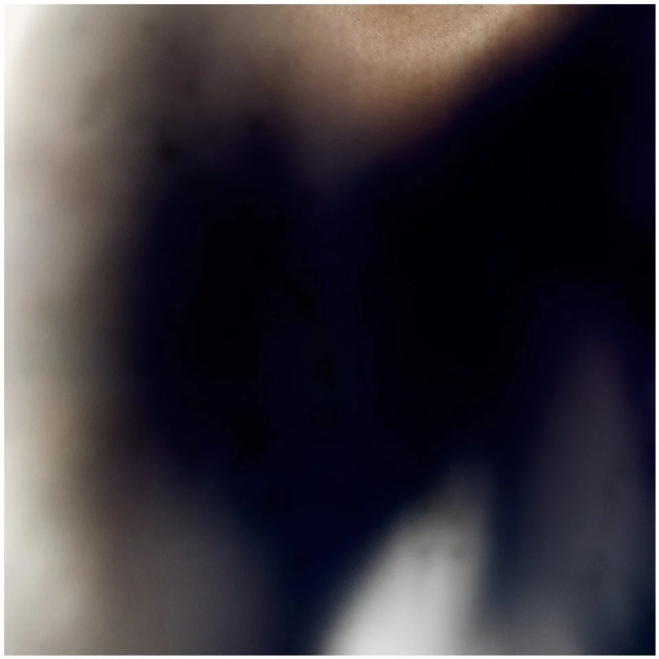 Skin V