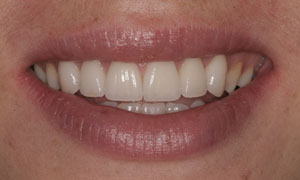 Cosmetic Dentists Santa Fe NM