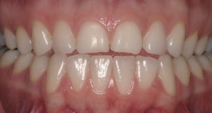 case4BeforeR.jpg