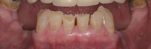 Cosmetic Dentists Santa Fe NM