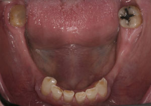 Cosmetic Dentists Santa Fe NM