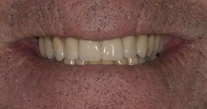 Cosmetic Dentists Santa Fe NM