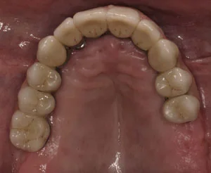 Cosmetic Dentists Santa Fe NM