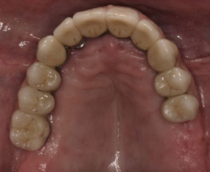 Cosmetic Dentists Santa Fe NM